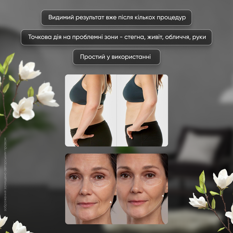 Массажер для тела антицеллюлитный вакуумный ультразвуковой 4в1 для похудения кавитационная лифтинг машина для лица омоложение сжигание жира 1750950887291 фото